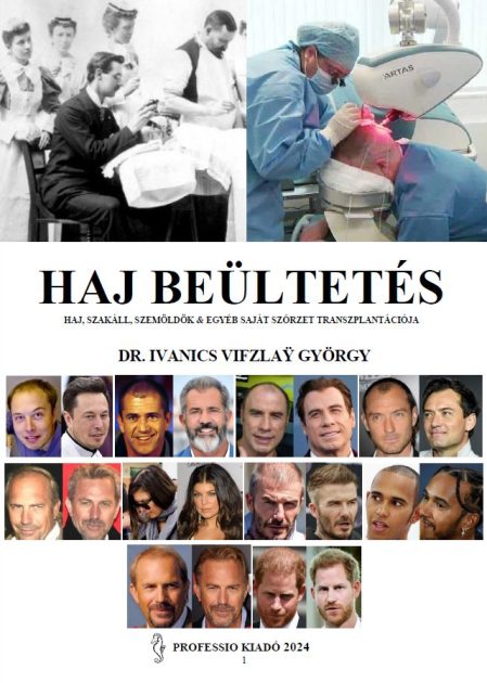 ' HajbeültetésCímlap